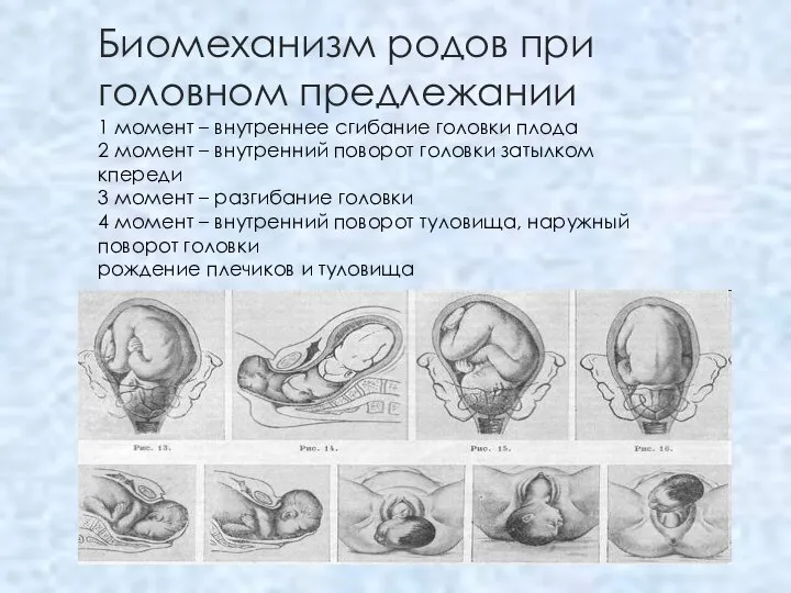 Биомеханизм родов при головном предлежании 1 момент – внутреннее сгибание головки плода