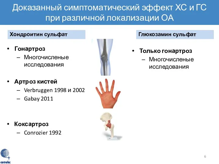 Доказанный симптоматический эффект ХС и ГС при различной локализации ОА Гонартроз Многочисленые