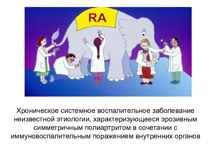 Хроническое системное воспалительное заболевание неизвестной этиологии, характеризующееся эрозивным симметричным полиартритом в сочетании