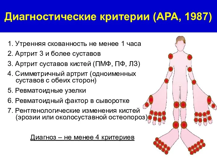 1. Утренняя скованность не менее 1 часа 2. Артрит 3 и более