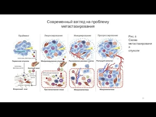 Современный взгляд на проблему метастазирования Рис. 6 Схема метастазирования опухоли