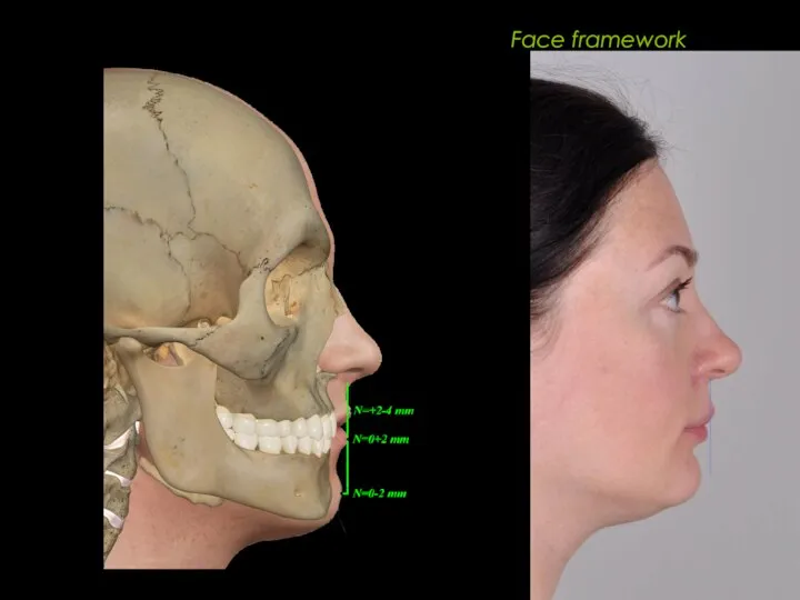 Face framework