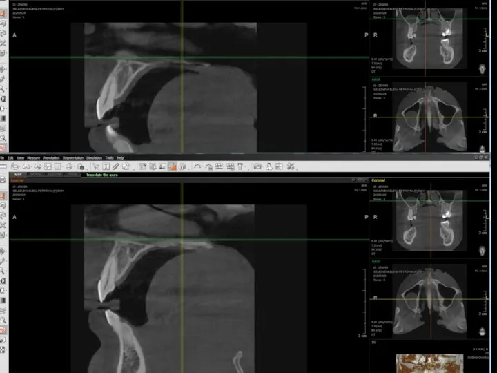 CBCT slices