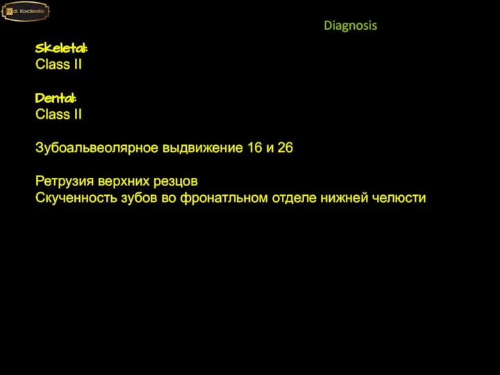 Skeletal: Class II Dental: Class II Зубоальвеолярное выдвижение 16 и 26 Ретрузия