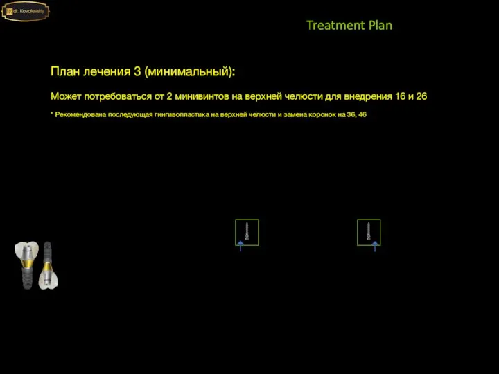 Treatment Plan План лечения 3 (минимальный): Может потребоваться от 2 минивинтов на