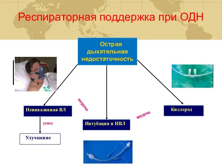 Респираторная поддержка при ОДН Неинвазивная ВЛ Улучшение успех Интубация и ИВЛ Кислород