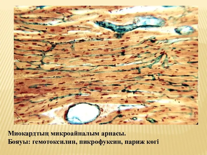 Миокардтың микроайналым арнасы. Бояуы: гемотоксилин, пикрофуксин, париж көгі www.ZHARAR.com
