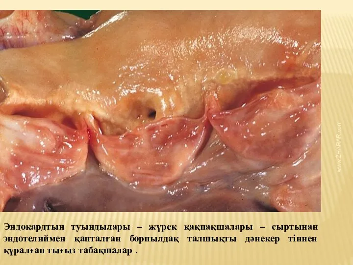 Эндокардтың туындылары – жүрек қақпақшалары – сыртынан эндотелиймен қапталған борпылдақ талшықты дәнекер