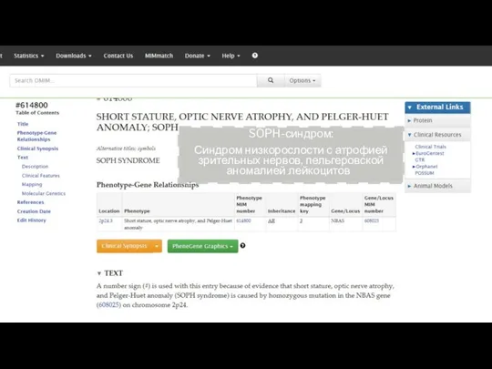 SOPH-синдром: Синдром низкорослости с атрофией зрительных нервов, пельгеровской аномалией лейкоцитов