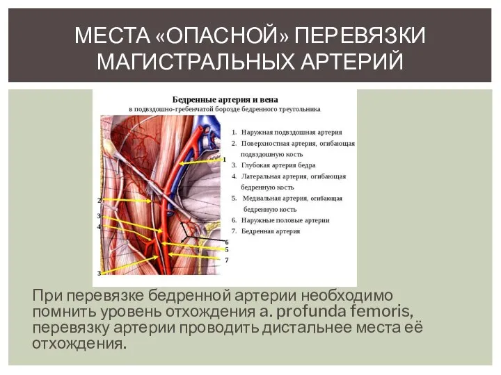 При перевязке бедренной артерии необходимо помнить уровень отхождения a. prоfunda femoris, перевязку