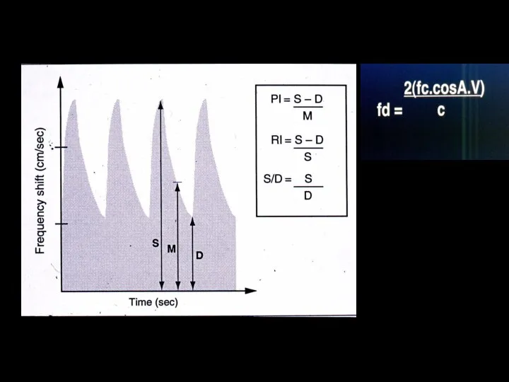 Doppler Indices