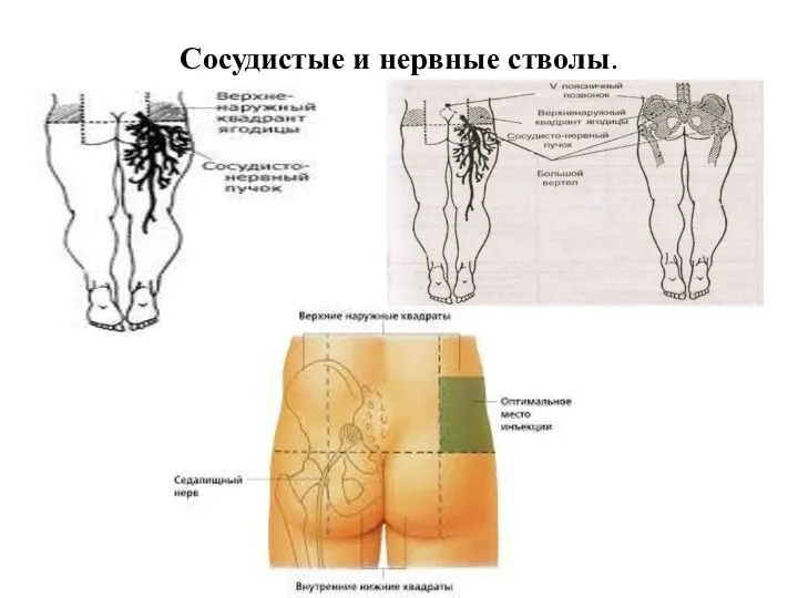 Сосудистые и нервные стволы.