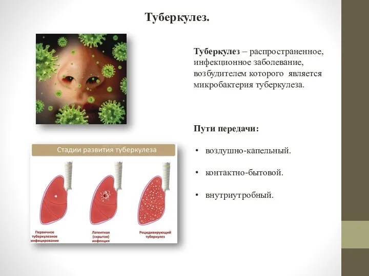 Туберкулез. Туберкулез – распространенное, инфекционное заболевание, возбудителем которого является микробактерия туберкулеза. Пути передачи: воздушно-капельный. контактно-бытовой. внутриутробный.