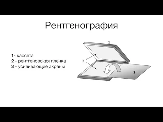 Рентгенография 1- кассета 2 - рентгеновская пленка 3 - усиливающие экраны