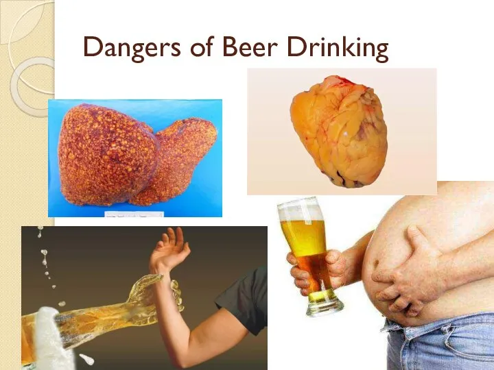 Dangers of Beer Drinking