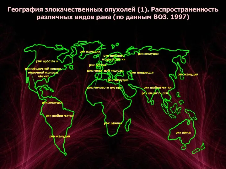 География злокачественных опухолей (1). Распространенность различных видов рака (по данным ВОЗ. 1997)