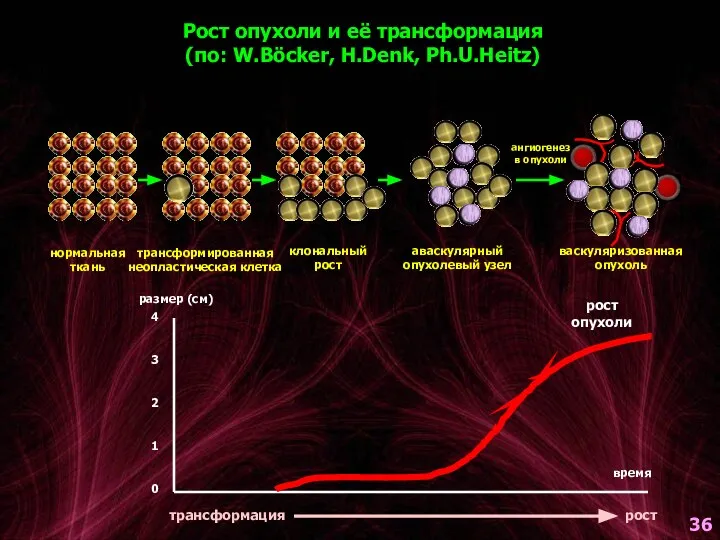 нормальная ткань трансформированная неопластическая клетка клональный рост аваскулярный опухолевый узел ангиогенез в