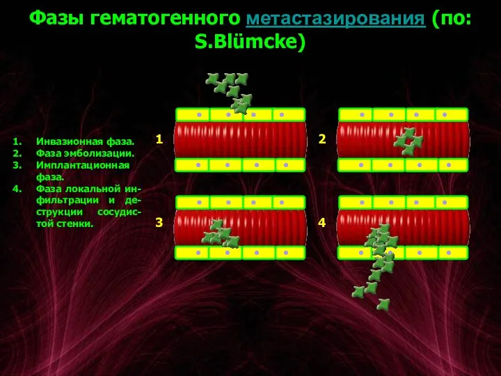 Фазы гематогенного метастазирования (по: S.Blümcke) Инвазионная фаза. Фаза эмболизации. Имплантационная фаза. Фаза