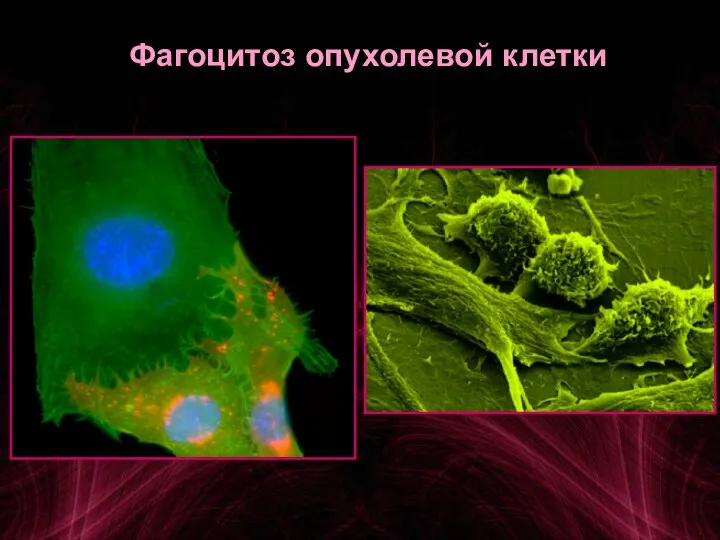 Фагоцитоз опухолевой клетки