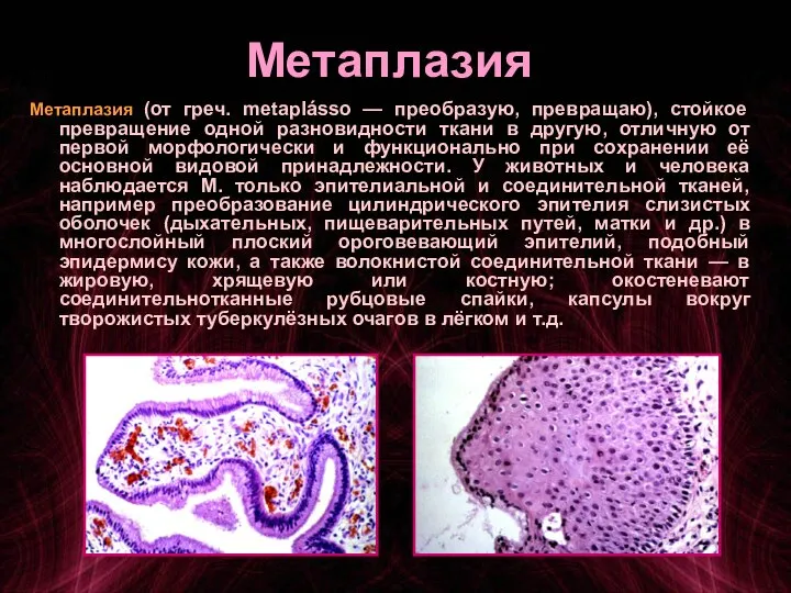 Метаплазия Метаплазия (от греч. metaplásso — преобразую, превращаю), стойкое превращение одной разновидности