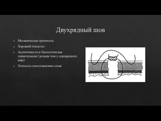 Двухрядный шов Механическая прочность Хороший гемостаз Асептичность и биологическая герметизация (дольше чем