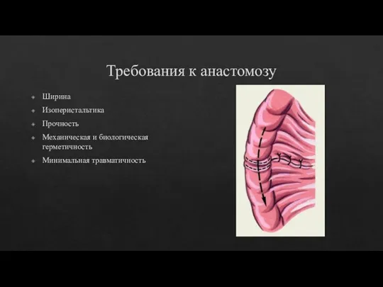 Требования к анастомозу Ширина Изоперистальтика Прочность Механическая и биологическая герметичность Минимальная травматичность