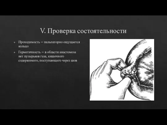 V. Проверка состоятельности Проходимость – пальпаторно ощущается кольцо Герметичность – в области