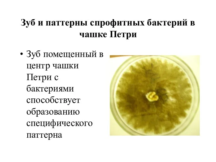 Зуб и паттерны спрофитных бактерий в чашке Петри Зуб помещенный в центр