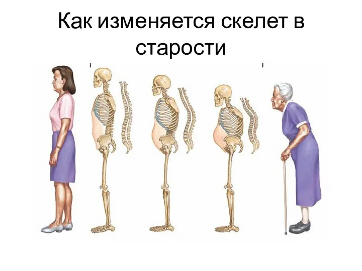 Как изменяется скелет в старости