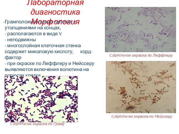 Лабораторная диагностика Морфология C.diphtheriae окраска по Леффлеру Грамположительные палочки с утолщениями на