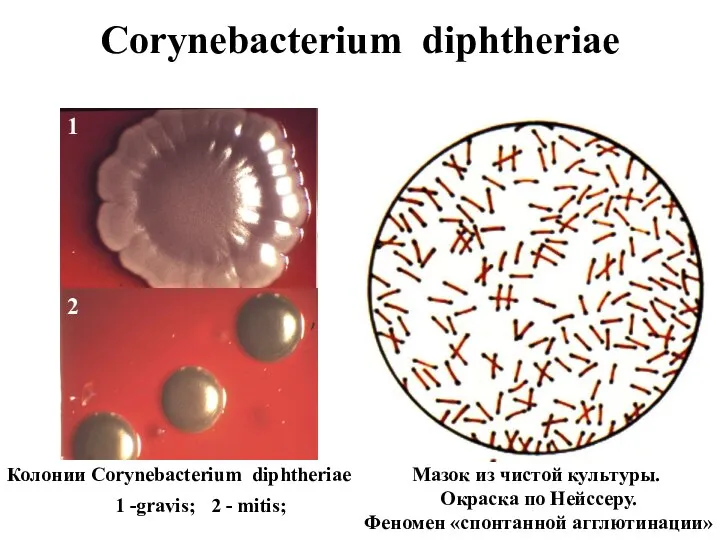 Corynebacterium diphtheriae Мазок из чистой культуры. Окраска по Нейссеру. Феномен «спонтанной агглютинации»