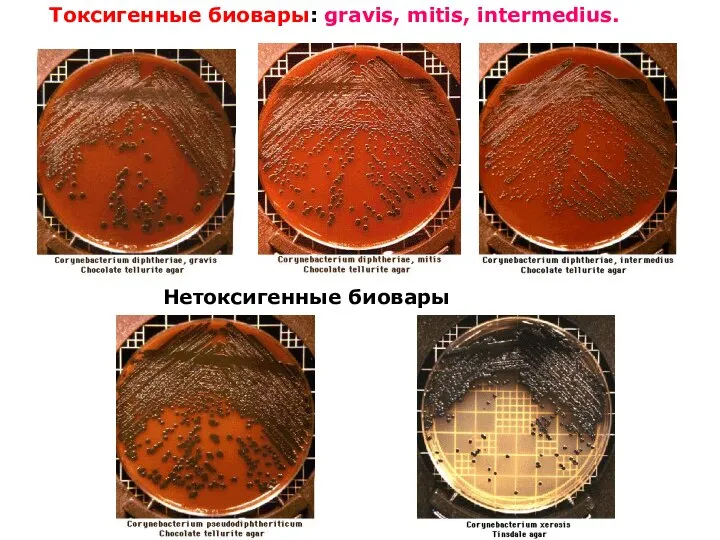 Токсигенные биовары: gravis, mitis, intermedius. Нетоксигенные биовары