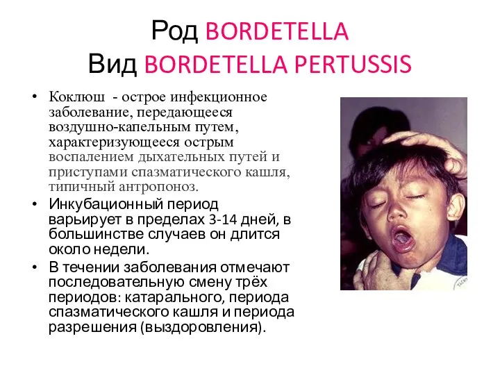 Род BORDETELLA Вид BORDETELLA PERTUSSIS Коклюш - острое инфекционное заболевание, передающееся воздушно-капельным