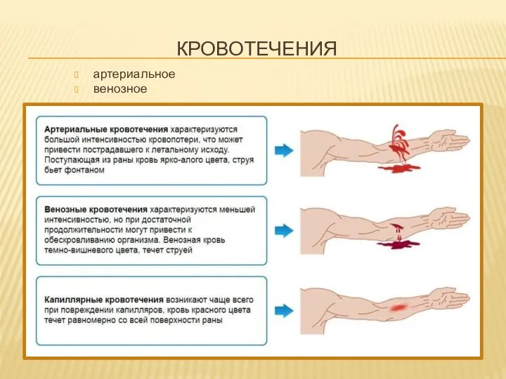 КРОВОТЕЧЕНИЯ артериальное венозное капиллярное внутреннее