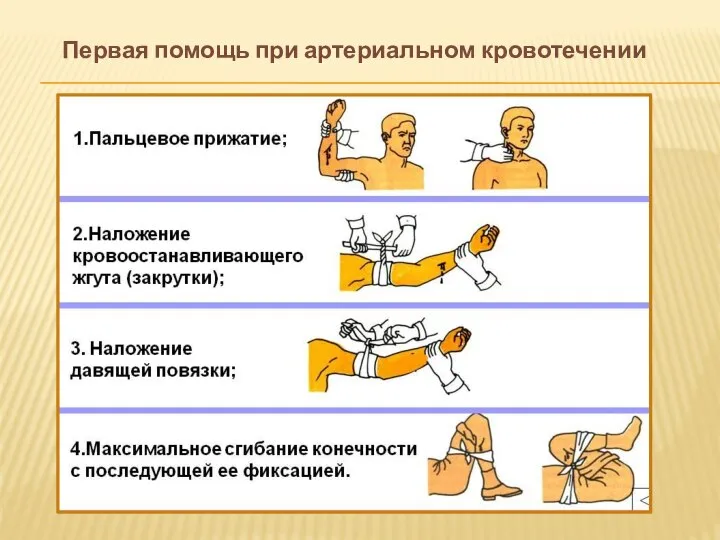 Первая помощь при артериальном кровотечении