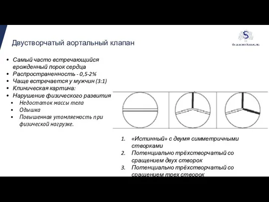 Двустворчатый аортальный клапан «Истинный» с двумя симметричными створками Потенциально трёхстворчатый со сращением