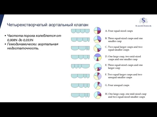 Четырехстворчатый аортальный клапан Частота порока колеблется от 0,008% до 0,033% Гемодинамически: аортальная недостаточность.