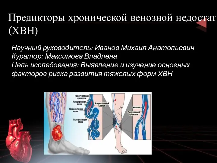 Предикторы хронической венозной недостаточности (ХВН) Научный руководитель: Иванов Михаил Анатольевич Куратор: Максимова