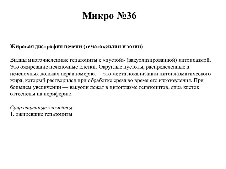 Микро №36 Жировая дистрофия печени (гематоксилин и эозин) Видны многочисленные гепатоциты с