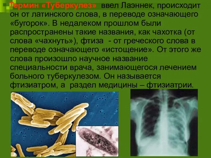 Термин «Туберкулез» ввел Лаэннек, происходит он от латинского слова, в переводе означающего