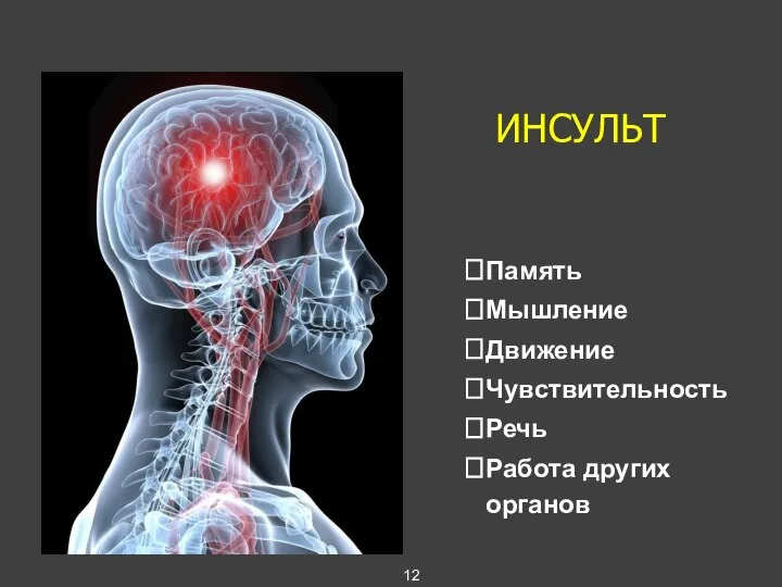 ИНСУЛЬТ Память Мышление Движение Чувствительность Речь Работа других органов