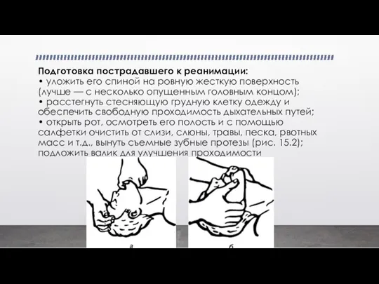 Подготовка пострадавшего к реанимации: • уложить его спиной на ровную жесткую поверхность