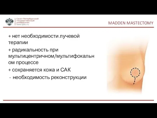 MADDEN MASTECTOMY + нет необходимости лучевой терапии + радикальность при мультицентричном/мультифокальном процессе