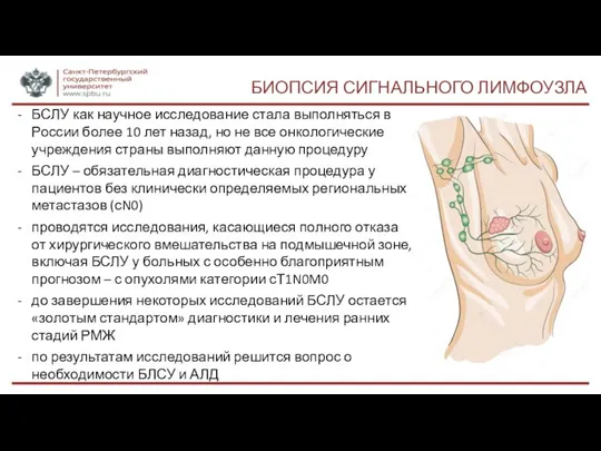 БИОПСИЯ СИГНАЛЬНОГО ЛИМФОУЗЛА БСЛУ как научное исследование стала выполняться в России более