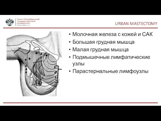 URBAN MASTECTOMY Молочная железа с кожей и САК Большая грудная мышца Малая