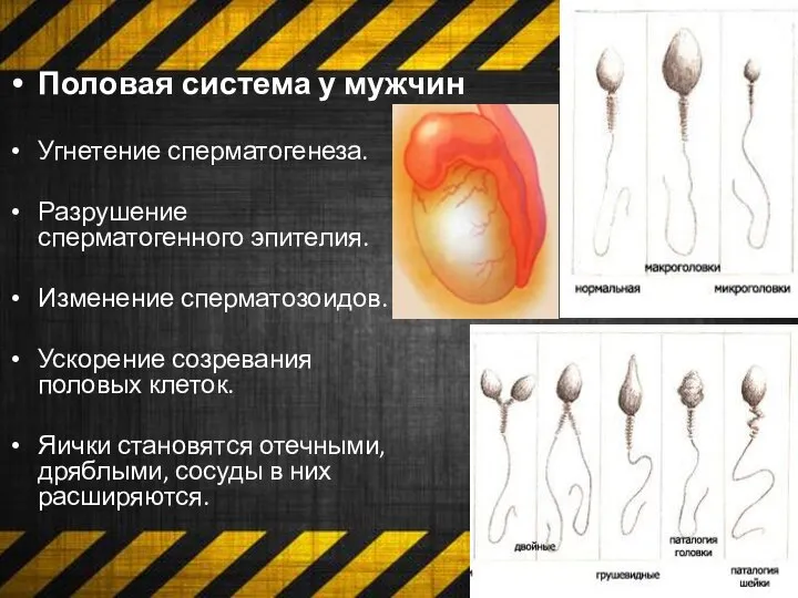 Половая система у мужчин Угнетение сперматогенеза. Разрушение сперматогенного эпителия. Изменение сперматозоидов. Ускорение