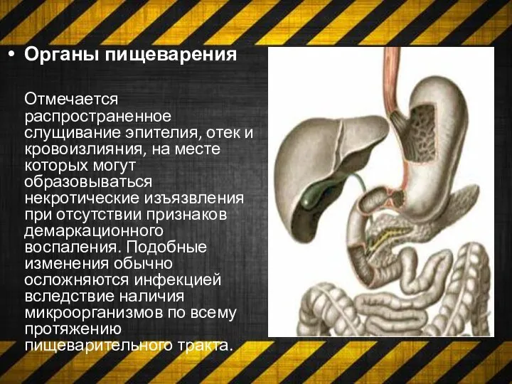 Отмечается распространенное слущивание эпителия, отек и кровоизлияния, на месте которых могут образовываться