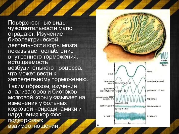 Поверхностные виды чувствительности мало страдают. Изучение биоэлектрической деятельности коры мозга показывает ослабление