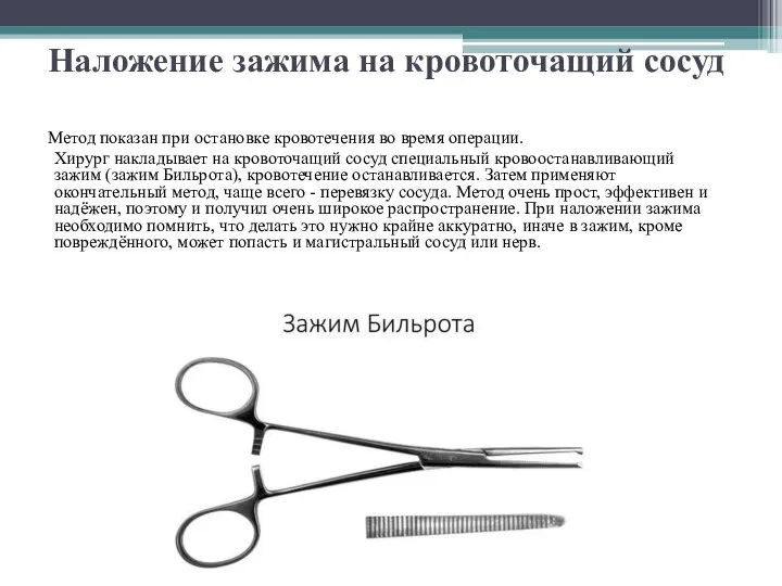 Наложение зажима на кровоточащий сосуд Метод показан при остановке кровотечения во время