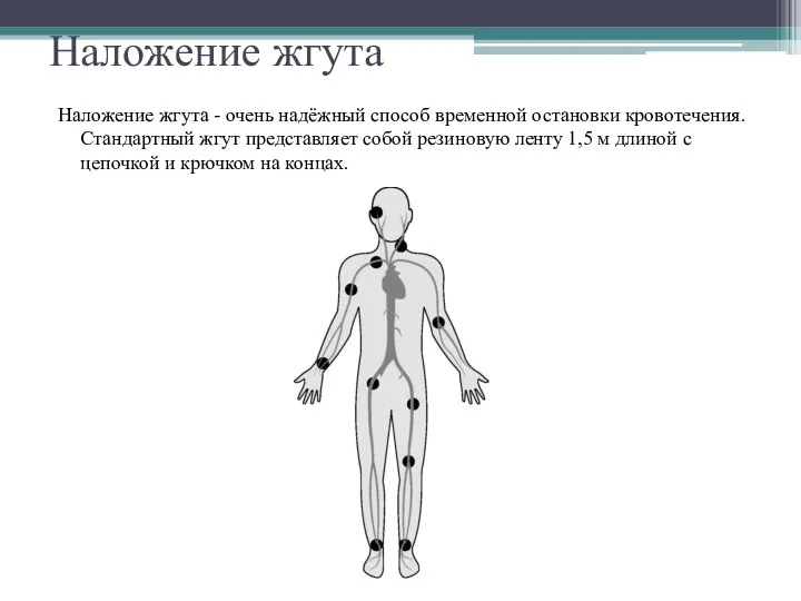 Наложение жгута Наложение жгута - очень надёжный способ временной остановки кровотечения. Стандартный